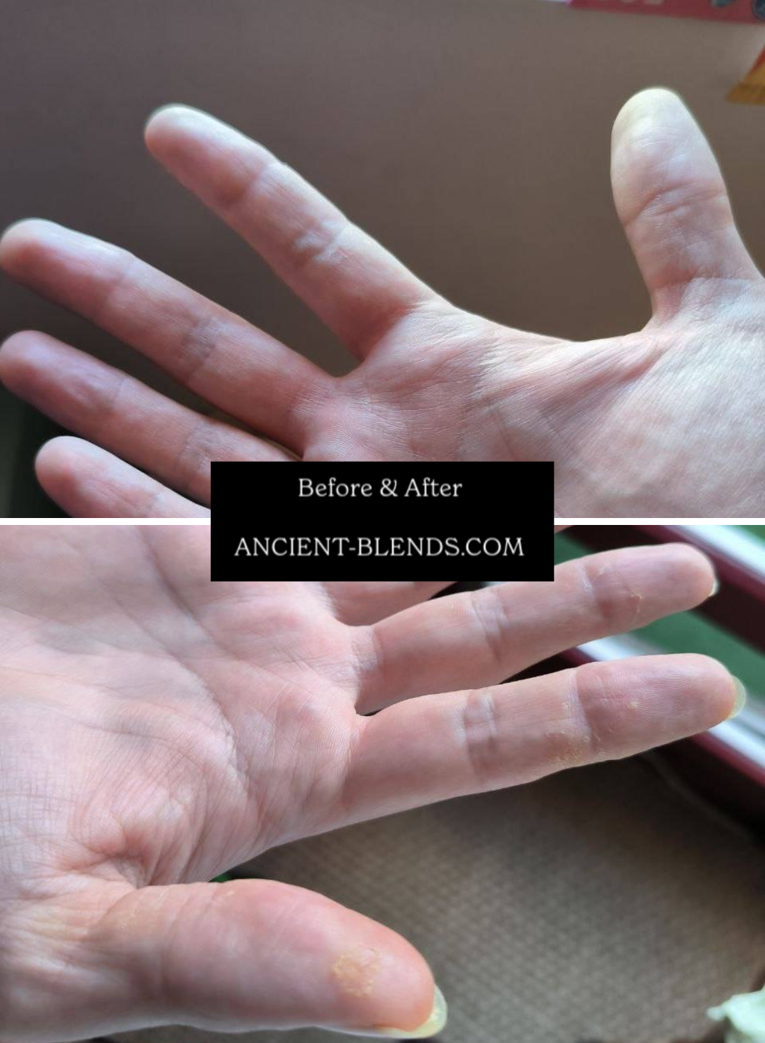 Organic Whipped Raw Shea Butter and Black Seed Oil