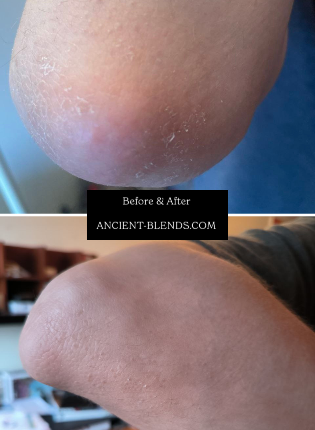 Organic Whipped Raw Shea Butter and Black Seed Oil